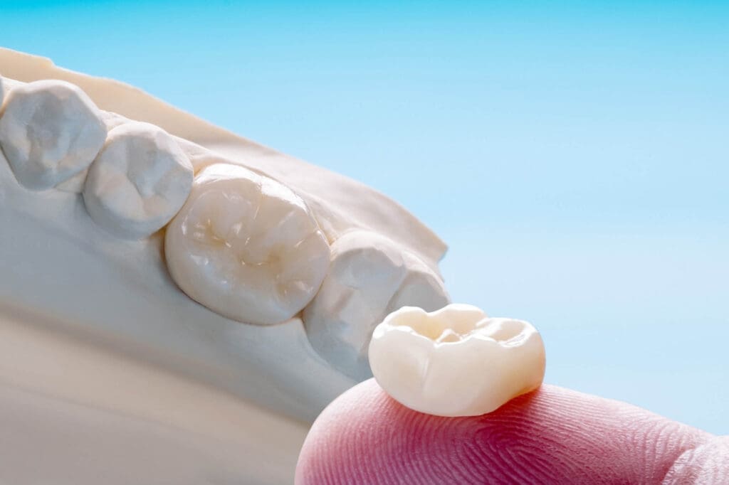 dental crowns in northville, michigan